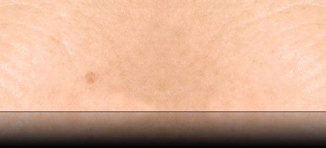 pH - skin